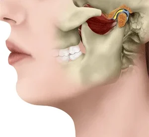 normalfunction-jaw