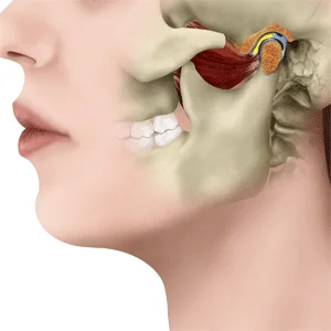 normalfunction-jaw